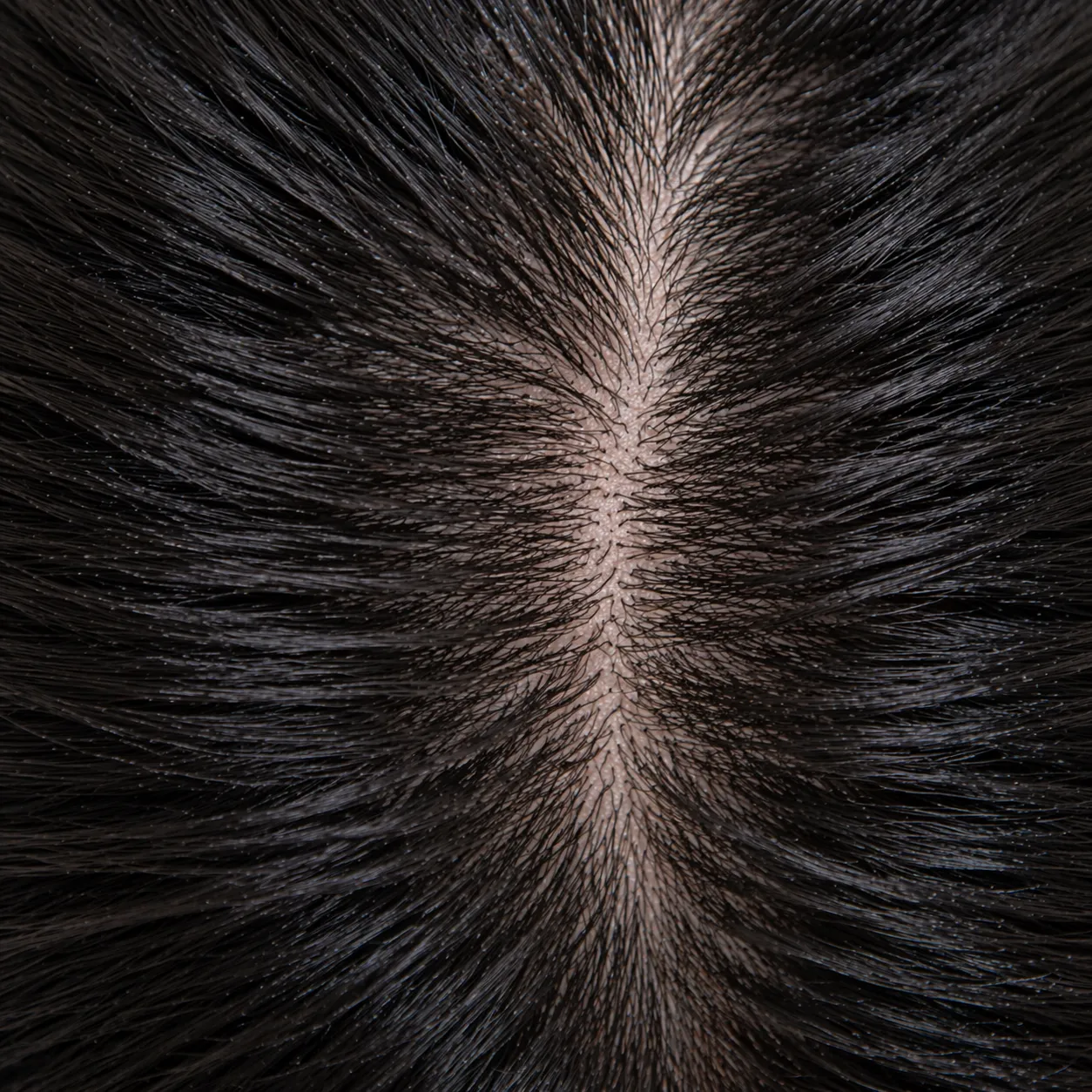 After FUE transplant